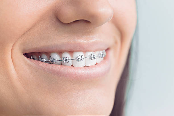 Best Invisalign and Clear Aligners  in West Jefferson, OH